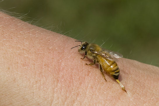Arı Alerjisi Aşısı
